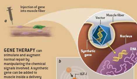 Iniezione di un gene nella fibra muscolare Vettore Fibra muscolare Nucleo Un gene sintetico, all interno un vettore, può essere