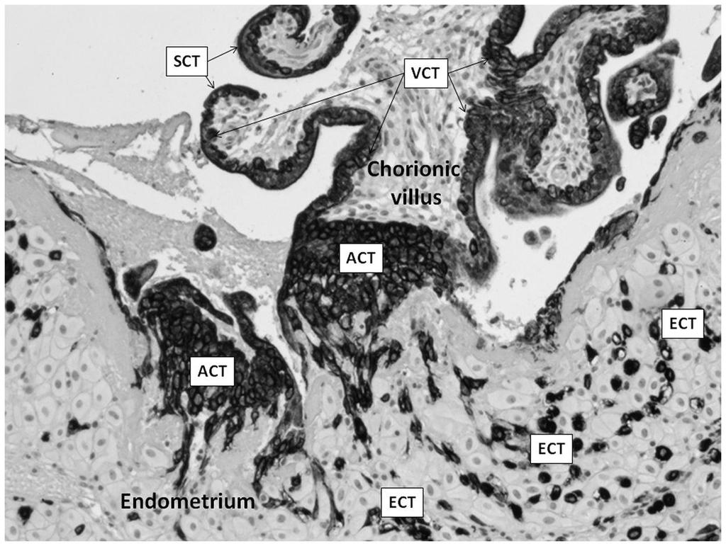 Villo di ancoraggio (ACT) ECT: citotrofoblasto extravilloso VCT: