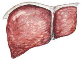 Patogenesi della Preeclampsia: