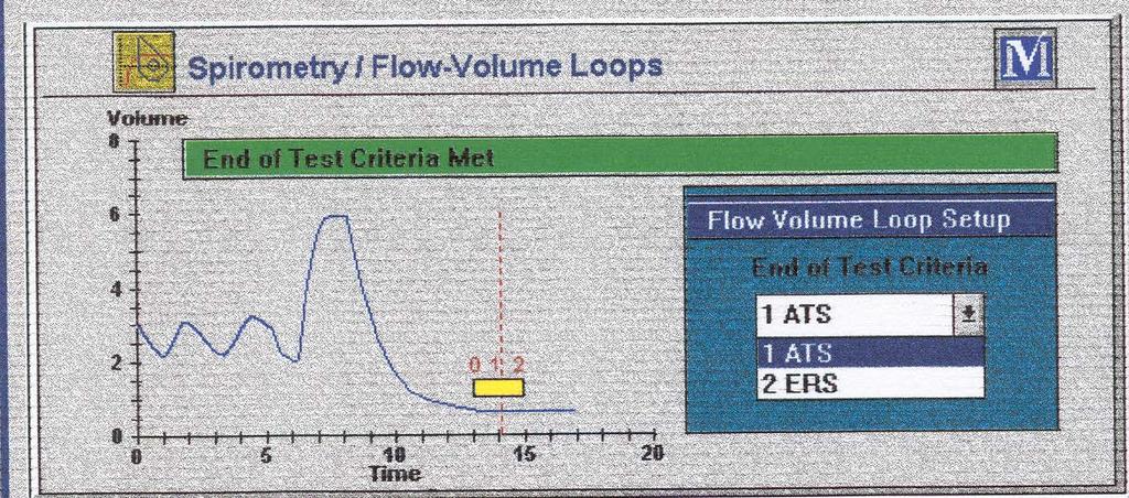 Criteri di fine test Il soggetto non può proseguire nell espirazione Insorgenza di evidenti segni di disagio La curva volume tempo non mostra