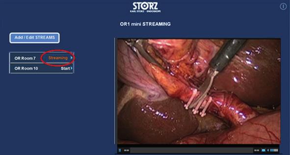 Se lo streaming dalla sala operatoria non è ancora stato avviato, potrebbe essere visualizzata un icona STANDBY.