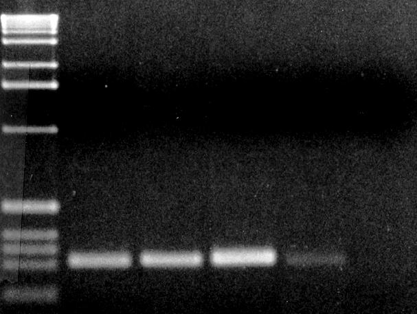 TNA PCR a singolo stadio Estratto di pianta Trascrizione inversa (RT) Primer specifico antisenso as cdna 1 2 3 4 5 6