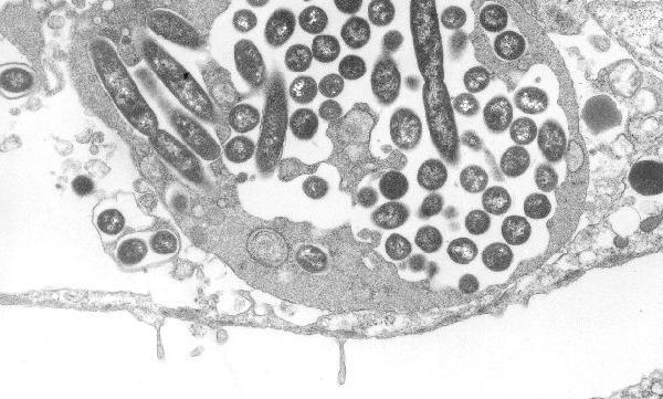 protozoi ciliati.