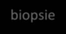 EGDS + biopsie : immediatamente dopo Sfintere Esofageo Superiore la mucosa appare mammellonata, focalmente erosa e fragile al trauma strumentale; tale aspetto si estende distalmente per circa 5 cm e