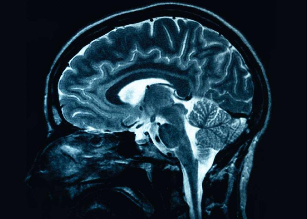 I tumori del Sistema Nervoso Centrale (SNC), e più in particolare i tumori cerebrali, presentano specificità caratterizzanti un peculiare percorso di cura, ripercussioni importanti sulla