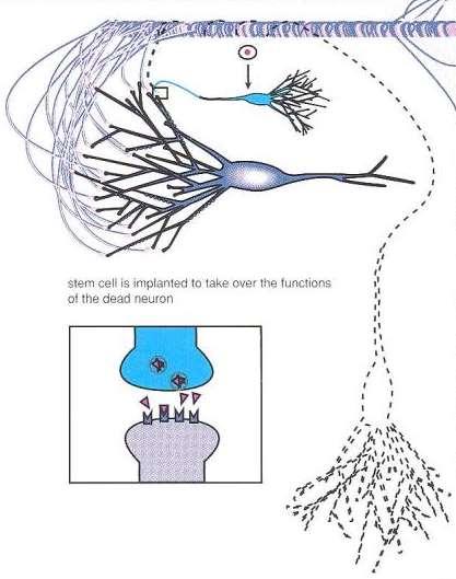 Neurosviluppo: neurogenesi Trapianto di precursori cellulari attraverso tecniche