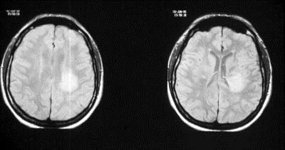 Diagnosi differenziale 6.