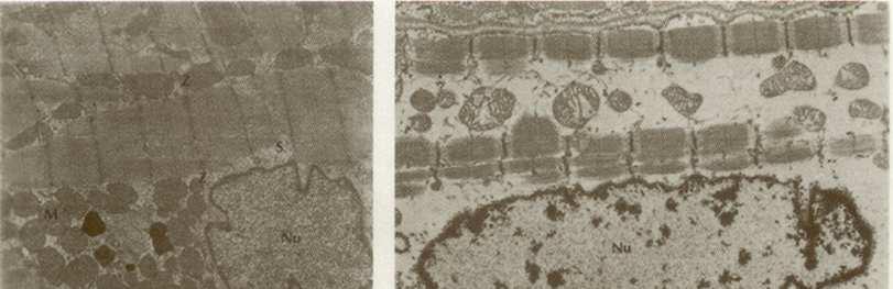 DANNO ISCHEMICO-1 Cromatina granulare dispersa Mitocondri: dimensioni uniformi numerose creste