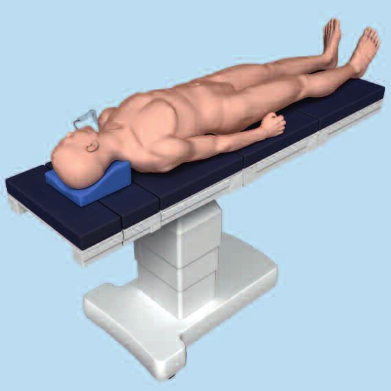 2 Posizionamento e preparazione del paziente Posizionare il paziente in posizione supina su un tavolo operatorio radiotrasparente.
