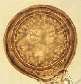 Le oospore si formano nelle foglie infette da luglio in poi Sintomi a mosaico Oosfera