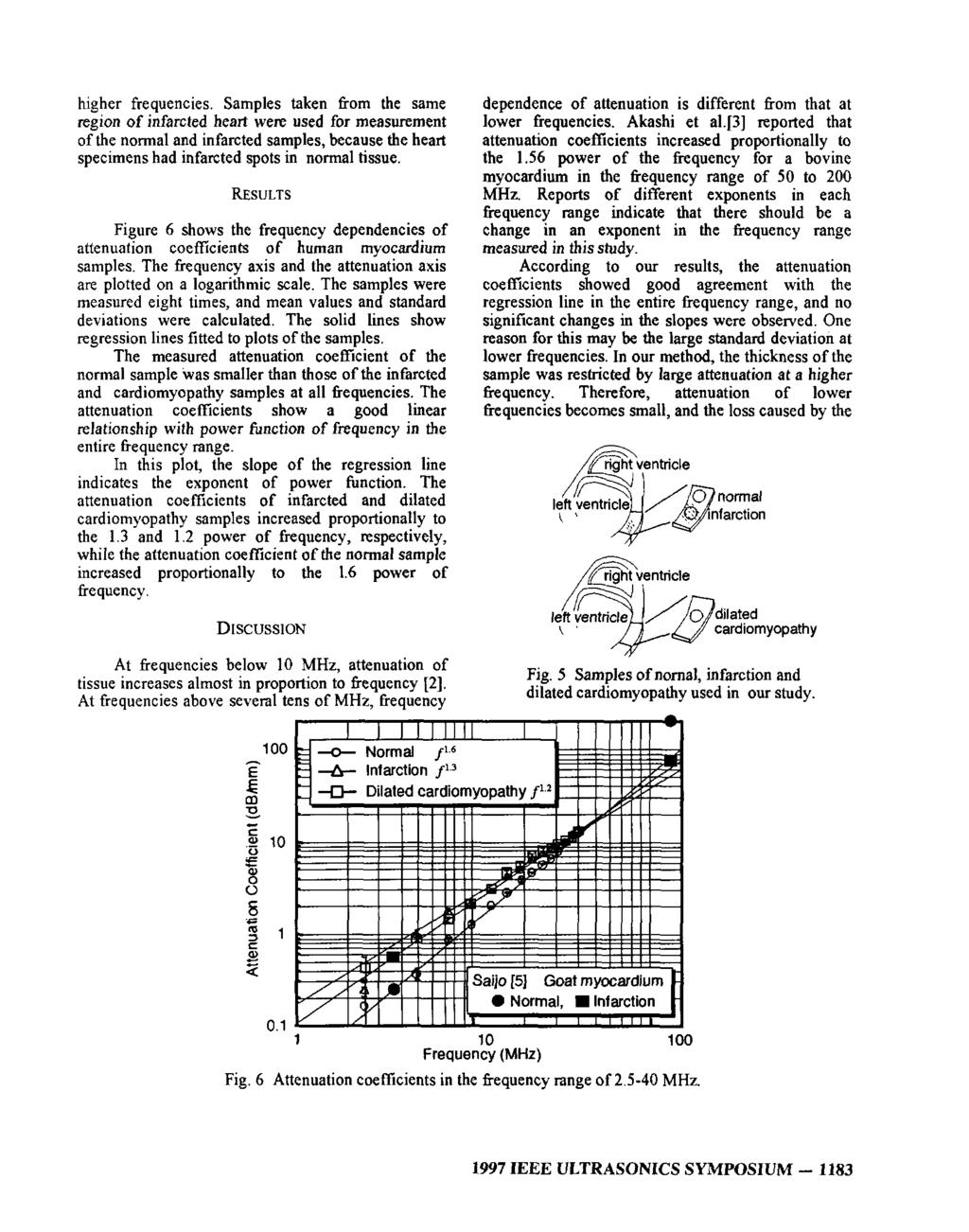 Convoluzione e TC Coefficiente di attenuazione del tessuto miocardico ad oscillazioni ultrasoniche alle diverse frequenze Il tessuto attenua maggiormente le oscillazioni a frequenze maggiori Questa è