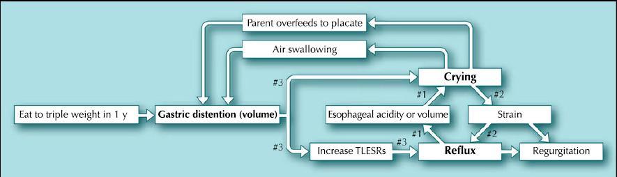 RIGURGITO Fisiopatologia Una recente revisione sulla relazione tra reflusso e sintomi supporta il concetto che, in lattanti, anche i sintomi come un eccessivo pianto accompagnato da un rigurgito