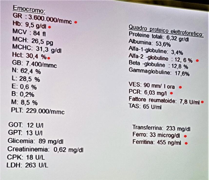 Ferritina alta e sidermia bassa è il profilo tipico di un anemia da malattia infiammatoria cronica, di cui riportiamo la fisiopatologia: Esami strumentali: rx del torace non segni di lesioni