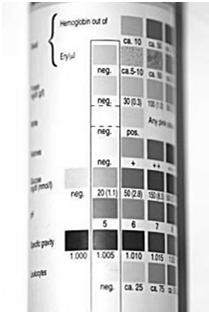 MICROEMATURIA SINTOMATICA non è visibile macroscopicamente riscontrata attraverso es.