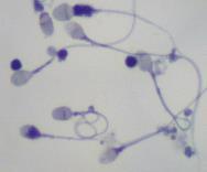 spermatozoo, una cellula