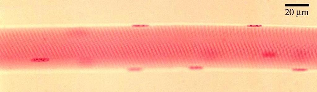 CELLULA (O FIBRA) MUSCOLARE SCHELETRICA cellule polinucleate (sincizi) nuclei allungati posti sotto la membrana (sarcolemma) citoplasma ricco di strutture filamentose