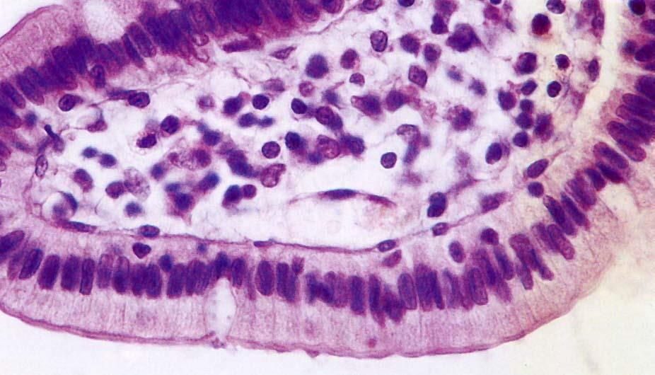 Specializzazioni cellulari con citoscheletro di actina: i