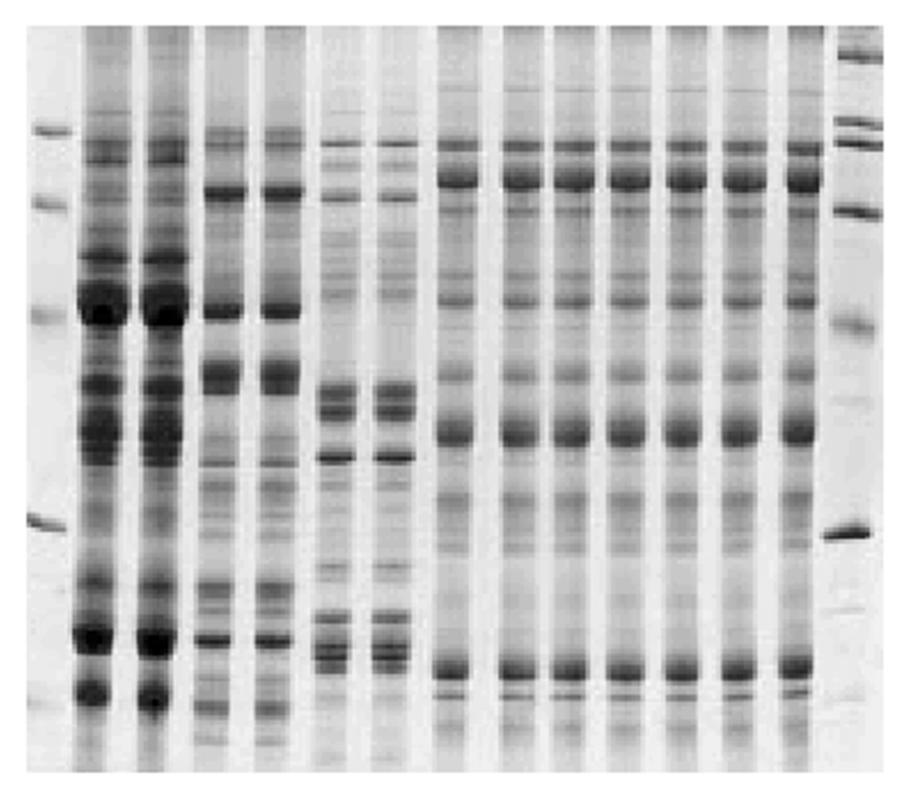 Elettroforesi L elettroforesi è una tecnica che consiste nella