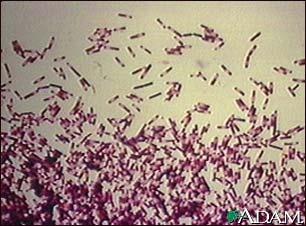 Clostridium difficile Bastoncino Gram pos, anaerobio, sporigeno, tossinogenico Ambiente, uomo, animali Portatori asintomatici