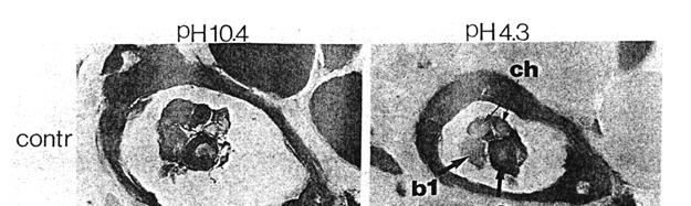 Azione intrafusale della Tossina Botulinica Evidenze