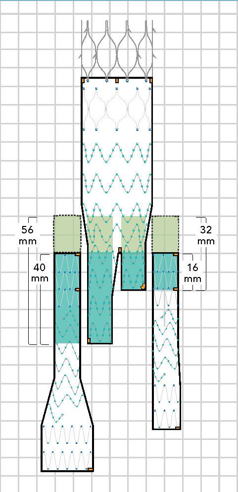 Sovrapposizione Controlaterale Quando il primo marker d oro è allineato con il marker sulla biforcazione del corpo principale, la sovrapposizione è pari a 16 (sovrapposizione equivalente a 2 stent).