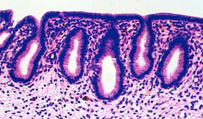 epiteli ghiandolari esocrini, morfologicamente sono distinti in: Ghiandole unicellulari rappresentate dalle cellule caliciformi mucipare che si trovano