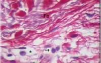 naturale Epidermis DERMA Fibroblasti Matrice