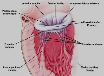 Mitral regurgitation