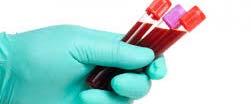 agenti anti sporigeni test di laboratorio rapidi per