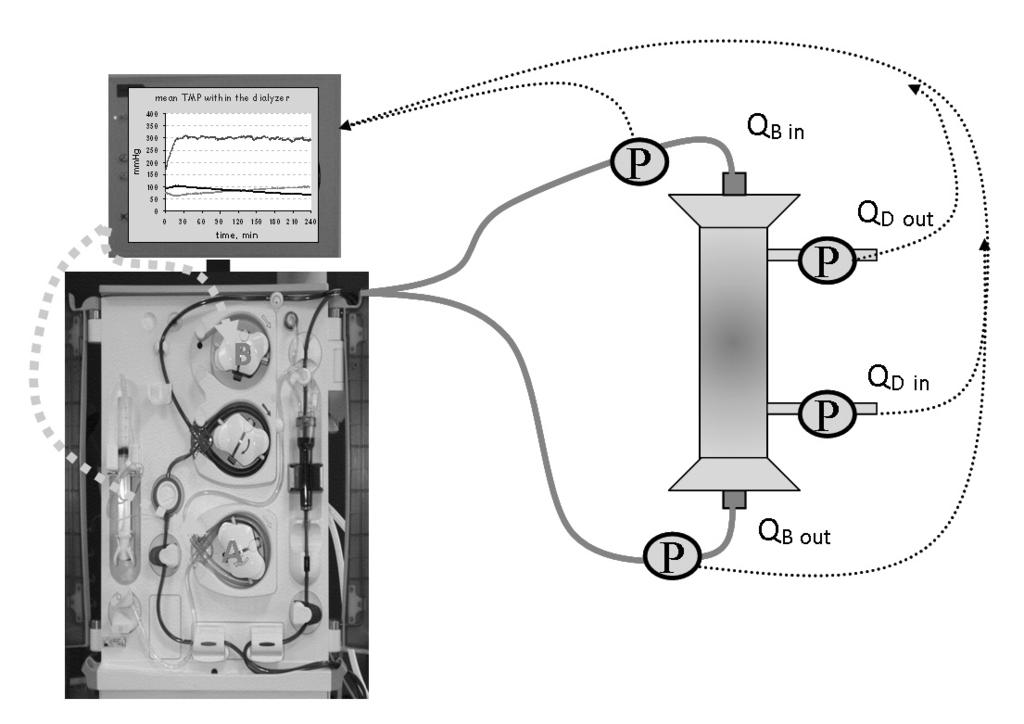 Emodiafiltrazione mista Fig. 1 - Rappresentazione schematica del sistema di emodiafiltrazione mista con controllo a feedback della TMP. Fig. 2 - Rappresentazione grafica della registrazione di una seduta di emodiafiltrazione mista.