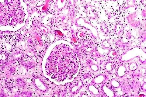 Colorazioni istologiche: acido+base Ematossilina-Eosina (EE) Ematossilina colora di blu o nero l eterocromatina e il citoplasma di cellule ricche di