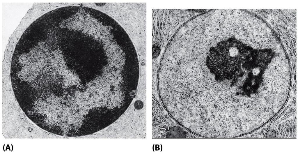 nuclei interfasici eterocromatina eucrocromatina si può regolare l