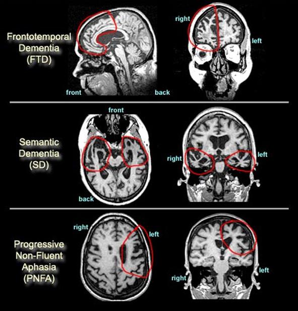 The clinical diagnosis and the