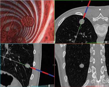 FUNZIONALITÀ Supporto visivo in realtà virtuale 3D e 4D Partendo da immagini tomografiche in formato DICOM, SIRIO crea un ambiente virtuale dello scenario operatorio.