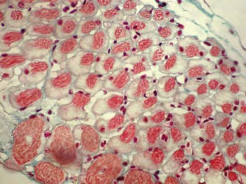 Nel preparato sono visibili fibre muscolari in sezione trasversale.