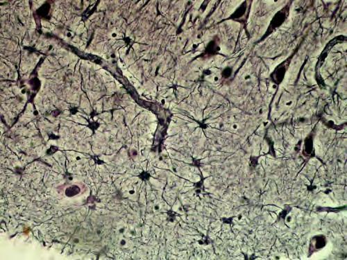 Nevroglia, astrociti a raggi lunghi della sostanza bianca Si osservano astrociti con lunghi prolungamenti, alcuni dei quali sono a