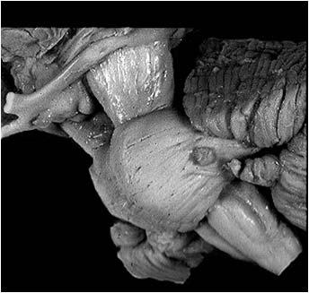 Cervelletto Comunica con encefalo, tronco