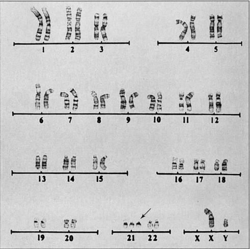 perché sono portatori di alleli diversi) I rimanenti due cromosomi