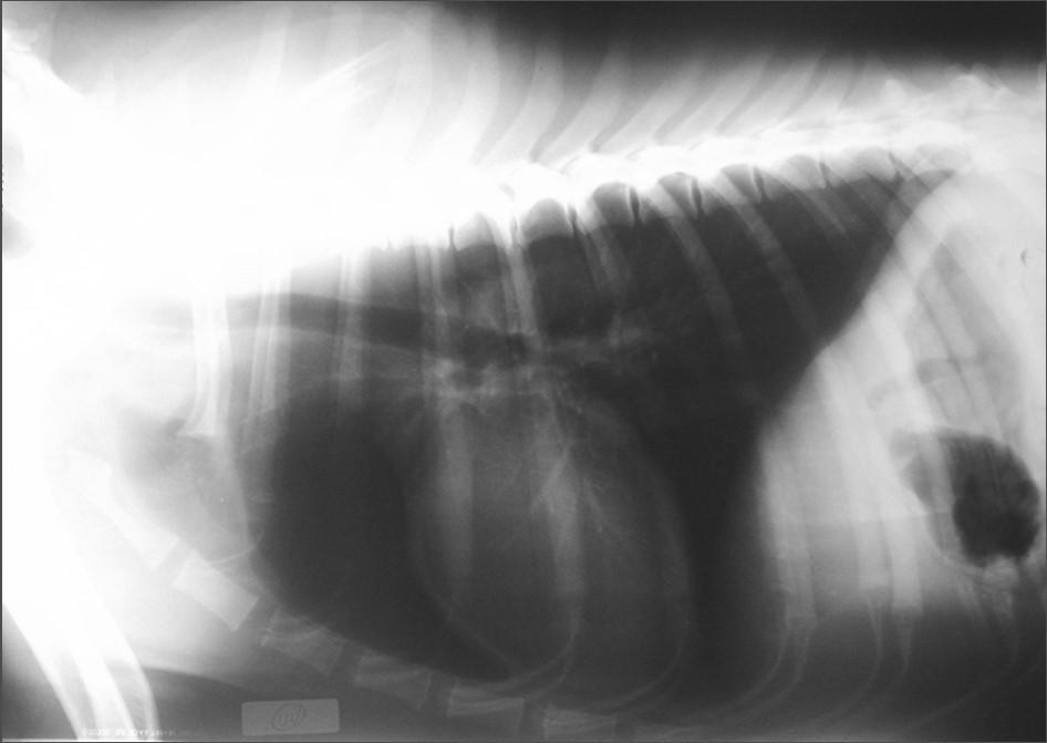 Anatomia radiografica normale 4 Recessi costodiaframmatici: -
