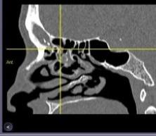 RINOALLERGOLOGIA E