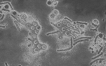 propagarsi nella comunità; ma di norma disponibili efficaci misure profilattiche o terapeutiche Es: Brucellosi Tubercolosi