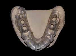 Dal centro B&B Dental invio allo studio odontoiatrico delle immagini sovrapposte, attraverso la stessa