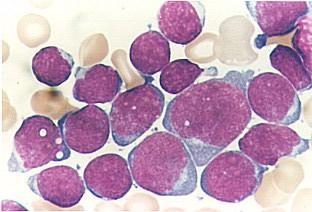 Cellule grandi, eterogenee Nucleoli, 1 o +, grandi Basofilia