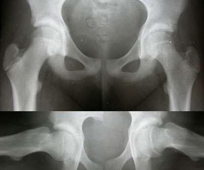 Diagnosi radiografica non limitarsi