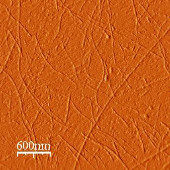 PROTEINS FOLDING AND MISFOLDING (II) Protofibrille: perline in catene o anelli; 2-5 nm di diametro; costituite da 2-6 monomeri proteici