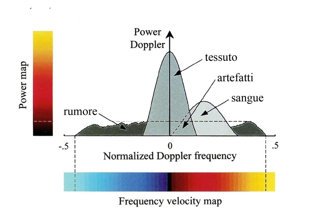 Color e Power Doppler 4.1.2 Power Doppler (PD) Una variante del color Doppler è il power Doppler.
