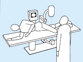 4 Posizionamento supino su un tavolo standard Il tavolo operatorio deve essere radiolucente. Il paziente viene posto in posizione supina.