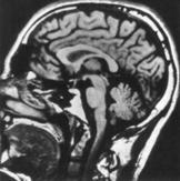 Sistema Nervoso Sistema Nervoso Centrale: Cervello e midollo spinale Sistema nervoso periferico: I neuroni che controllano i muscoli e i recettori periferici Giulio Sandini 11 SNC 11 KS Ilsistema