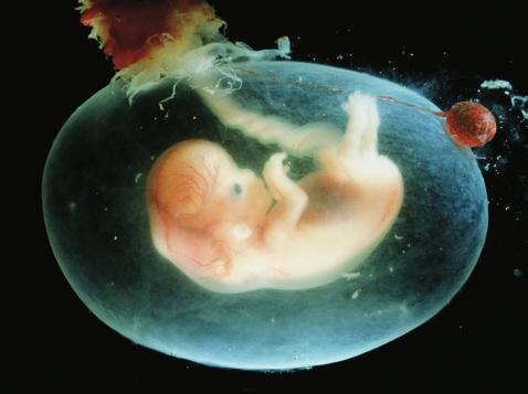 La placenta è una massa discoidale di tessuto spugnoso formatasi a partire dal corion e dall endometrio materno.