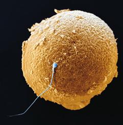 nucleo acrosoma rivestimento gelatinoso cellula uovo testa dello spermatozoo membrana cellulare enzimi dell acrosoma nucleo della cellula uovo recettori proteici che si legano agli spermatozoi i